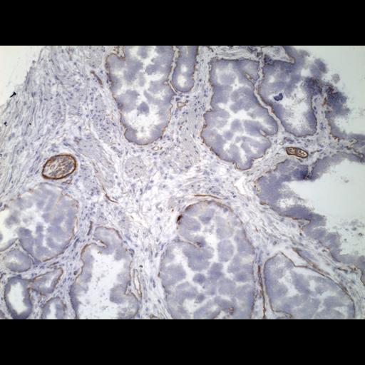  NCBI Organism:Homo sapiens; Cell Types:endocrine-paracrine cell of prostate gland, basal cell of prostate epithelium, luminal cell of prostate epithelium, blood vessel endothelial cell, perineural cell, sheath cell, leukocyte, prostate stromal cell, smooth muscle cell of prostate; Cell Components:nucleus, cell surface;