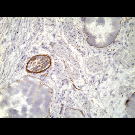  NCBI Organism:Homo sapiens; Cell Types:endocrine-paracrine cell of prostate gland, basal cell of prostate epithelium, luminal cell of prostate epithelium, blood vessel endothelial cell, perineural cell, sheath cell, leukocyte, prostate stromal cell, smooth muscle cell of prostate; Cell Components:nucleus, cell surface;