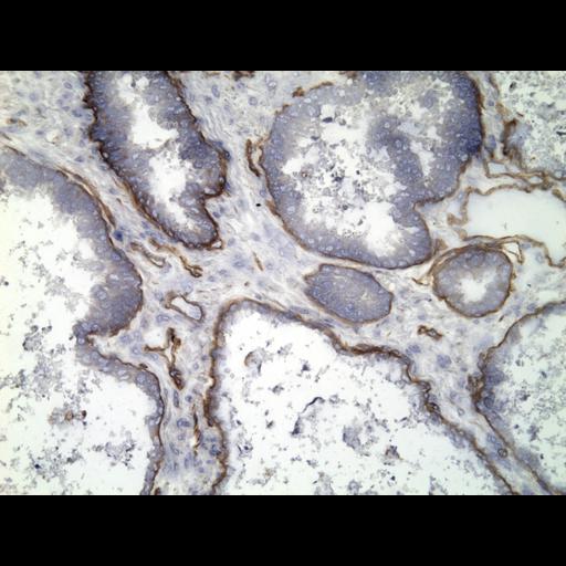  NCBI Organism:Homo sapiens; Cell Types:endocrine-paracrine cell of prostate gland, basal cell of prostate epithelium, luminal cell of prostate epithelium, blood vessel endothelial cell, perineural cell, sheath cell, leukocyte, prostate stromal cell, smooth muscle cell of prostate; Cell Components:nucleus, cell surface;