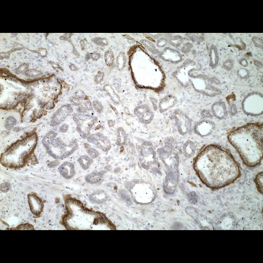  NCBI Organism:Homo sapiens; Cell Types:endocrine-paracrine cell of prostate gland, basal cell of prostate epithelium, luminal cell of prostate epithelium, blood vessel endothelial cell, perineural cell, sheath cell, leukocyte, prostate stromal cell, smooth muscle cell of prostate; Cell Components:nucleus, cell surface;