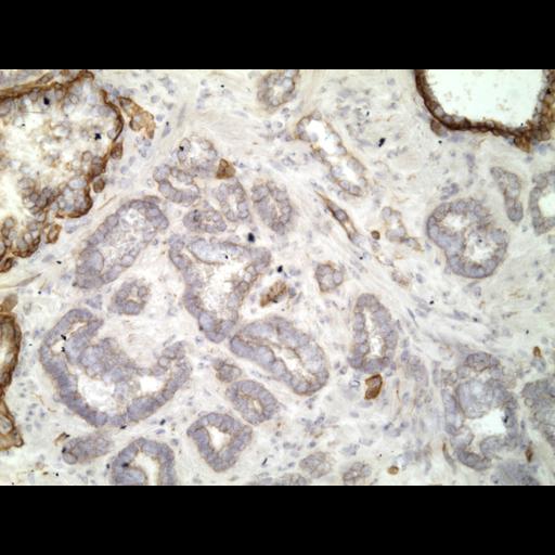  NCBI Organism:Homo sapiens; Cell Types:endocrine-paracrine cell of prostate gland, basal cell of prostate epithelium, luminal cell of prostate epithelium, blood vessel endothelial cell, perineural cell, sheath cell, leukocyte, prostate stromal cell, smooth muscle cell of prostate; Cell Components:nucleus, cell surface;