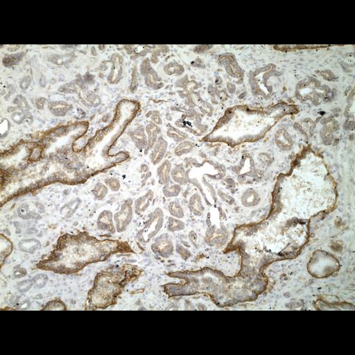  NCBI Organism:Homo sapiens; Cell Types:endocrine-paracrine cell of prostate gland, basal cell of prostate epithelium, luminal cell of prostate epithelium, blood vessel endothelial cell, perineural cell, sheath cell, leukocyte, prostate stromal cell, smooth muscle cell of prostate; Cell Components:nucleus, cell surface;