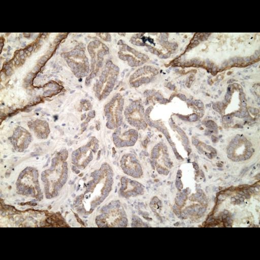  NCBI Organism:Homo sapiens; Cell Types:endocrine-paracrine cell of prostate gland, basal cell of prostate epithelium, luminal cell of prostate epithelium, blood vessel endothelial cell, perineural cell, sheath cell, leukocyte, prostate stromal cell, smooth muscle cell of prostate; Cell Components:nucleus, cell surface;