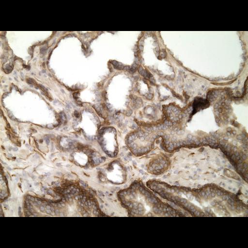  NCBI Organism:Homo sapiens; Cell Types:endocrine-paracrine cell of prostate gland, basal cell of prostate epithelium, luminal cell of prostate epithelium, blood vessel endothelial cell, perineural cell, sheath cell, leukocyte, prostate stromal cell, smooth muscle cell of prostate; Cell Components:nucleus, cell surface;