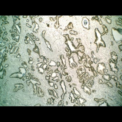  NCBI Organism:Homo sapiens; Cell Types:endocrine-paracrine cell of prostate gland, basal cell of prostate epithelium, luminal cell of prostate epithelium, blood vessel endothelial cell, perineural cell, sheath cell, leukocyte, prostate stromal cell, smooth muscle cell of prostate; Cell Components:nucleus, cell surface;