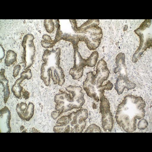  NCBI Organism:Homo sapiens; Cell Types:endocrine-paracrine cell of prostate gland, basal cell of prostate epithelium, luminal cell of prostate epithelium, blood vessel endothelial cell, perineural cell, sheath cell, leukocyte, prostate stromal cell, smooth muscle cell of prostate; Cell Components:nucleus, cell surface;