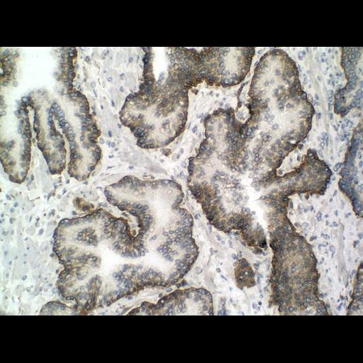  NCBI Organism:Homo sapiens; Cell Types:endocrine-paracrine cell of prostate gland, basal cell of prostate epithelium, luminal cell of prostate epithelium, blood vessel endothelial cell, perineural cell, sheath cell, leukocyte, prostate stromal cell, smooth muscle cell of prostate; Cell Components:nucleus, cell surface;