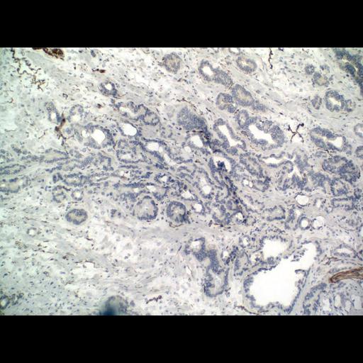  NCBI Organism:Homo sapiens; Cell Types:endocrine-paracrine cell of prostate gland, basal cell of prostate epithelium, luminal cell of prostate epithelium, blood vessel endothelial cell, perineural cell, sheath cell, leukocyte, prostate stromal cell, smooth muscle cell of prostate; Cell Components:nucleus, cell surface;