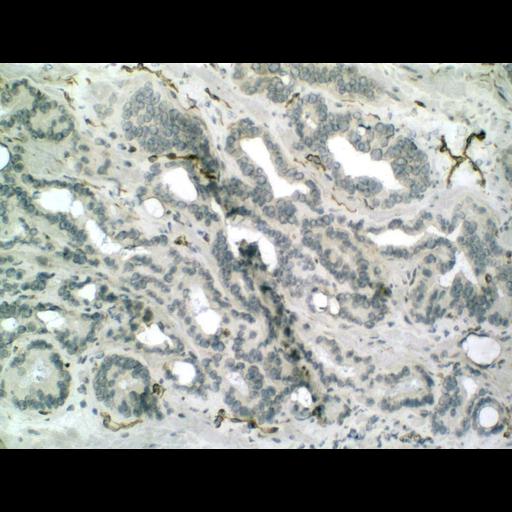  NCBI Organism:Homo sapiens; Cell Types:endocrine-paracrine cell of prostate gland, basal cell of prostate epithelium, luminal cell of prostate epithelium, blood vessel endothelial cell, perineural cell, sheath cell, leukocyte, prostate stromal cell, smooth muscle cell of prostate; Cell Components:nucleus, cell surface;