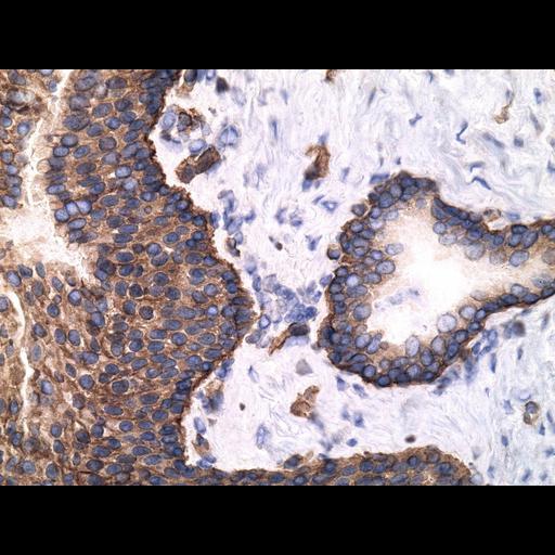  NCBI Organism:Homo sapiens; Cell Types:endocrine-paracrine cell of prostate gland, basal cell of prostate epithelium, luminal cell of prostate epithelium, blood vessel endothelial cell, perineural cell, sheath cell, leukocyte, prostate stromal cell, smooth muscle cell of prostate; Cell Components:nucleus, cell surface;