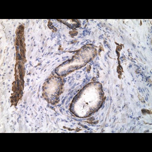  NCBI Organism:Homo sapiens; Cell Types:endocrine-paracrine cell of prostate gland, basal cell of prostate epithelium, luminal cell of prostate epithelium, blood vessel endothelial cell, perineural cell, sheath cell, leukocyte, prostate stromal cell, smooth muscle cell of prostate; Cell Components:nucleus, cell surface;