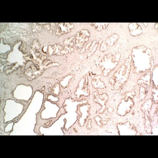  NCBI Organism:Homo sapiens; Cell Types:endocrine-paracrine cell of prostate gland, basal cell of prostate epithelium, luminal cell of prostate epithelium, blood vessel endothelial cell, perineural cell, sheath cell, leukocyte, prostate stromal cell, smooth muscle cell of prostate; Cell Components:nucleus, cell surface;