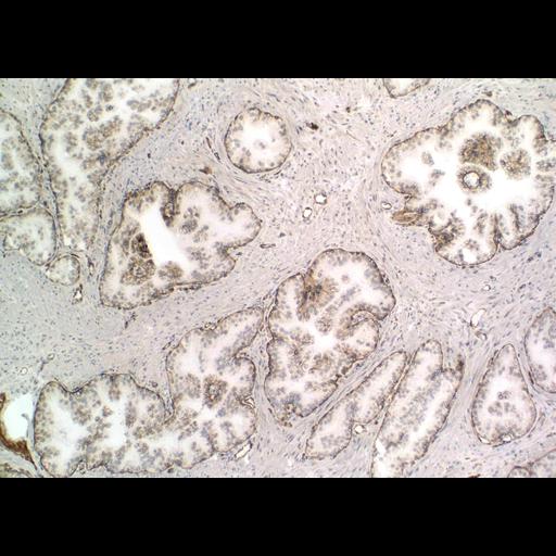  NCBI Organism:Homo sapiens; Cell Types:endocrine-paracrine cell of prostate gland, basal cell of prostate epithelium, luminal cell of prostate epithelium, blood vessel endothelial cell, perineural cell, sheath cell, leukocyte, prostate stromal cell, smooth muscle cell of prostate; Cell Components:nucleus, cell surface;