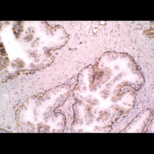  NCBI Organism:Homo sapiens; Cell Types:endocrine-paracrine cell of prostate gland, basal cell of prostate epithelium, luminal cell of prostate epithelium, blood vessel endothelial cell, perineural cell, sheath cell, leukocyte, prostate stromal cell, smooth muscle cell of prostate; Cell Components:nucleus, cell surface;