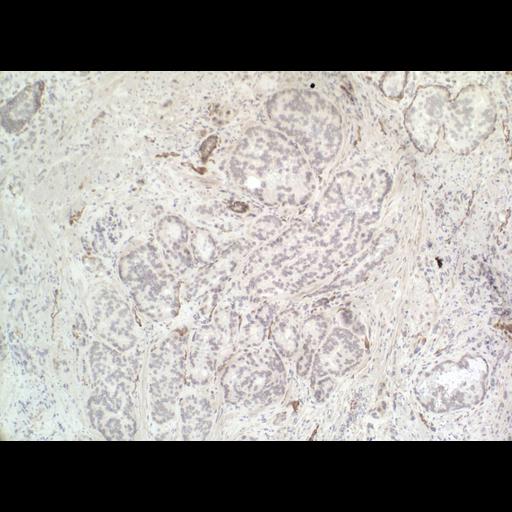  NCBI Organism:Homo sapiens; Cell Types:endocrine-paracrine cell of prostate gland, basal cell of prostate epithelium, luminal cell of prostate epithelium, blood vessel endothelial cell, perineural cell, sheath cell, leukocyte, prostate stromal cell, smooth muscle cell of prostate; Cell Components:nucleus, cell surface;