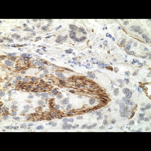  NCBI Organism:Homo sapiens; Cell Types:endocrine-paracrine cell of prostate gland, basal cell of prostate epithelium, luminal cell of prostate epithelium, blood vessel endothelial cell, perineural cell, sheath cell, leukocyte, prostate stromal cell, smooth muscle cell of prostate; Cell Components:nucleus, cell surface;