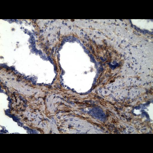  NCBI Organism:Homo sapiens; Cell Types:endocrine-paracrine cell of prostate gland, basal cell of prostate epithelium, luminal cell of prostate epithelium, blood vessel endothelial cell, perineural cell, sheath cell, leukocyte, prostate stromal cell, smooth muscle cell of prostate; Cell Components:nucleus, cell surface;