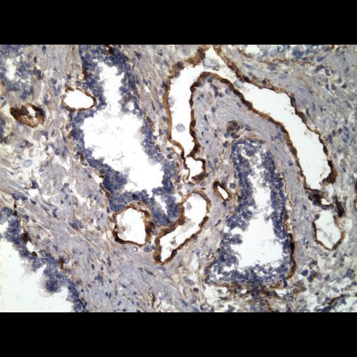  NCBI Organism:Homo sapiens; Cell Types:endocrine-paracrine cell of prostate gland, basal cell of prostate epithelium, luminal cell of prostate epithelium, blood vessel endothelial cell, perineural cell, sheath cell, leukocyte, prostate stromal cell, smooth muscle cell of prostate; Cell Components:nucleus, cell surface;