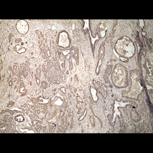  NCBI Organism:Homo sapiens; Cell Types:endocrine-paracrine cell of prostate gland, basal cell of prostate epithelium, luminal cell of prostate epithelium, blood vessel endothelial cell, perineural cell, sheath cell, leukocyte, prostate stromal cell, smooth muscle cell of prostate; Cell Components:nucleus, cell surface;