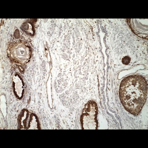  NCBI Organism:Homo sapiens; Cell Types:endocrine-paracrine cell of prostate gland, basal cell of prostate epithelium, luminal cell of prostate epithelium, blood vessel endothelial cell, perineural cell, sheath cell, leukocyte, prostate stromal cell, smooth muscle cell of prostate; Cell Components:nucleus, cell surface;