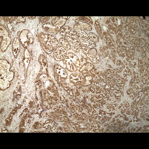  NCBI Organism:Homo sapiens; Cell Types:endocrine-paracrine cell of prostate gland, basal cell of prostate epithelium, luminal cell of prostate epithelium, blood vessel endothelial cell, perineural cell, sheath cell, leukocyte, prostate stromal cell, smooth muscle cell of prostate; Cell Components:nucleus, cell surface;