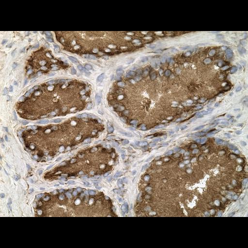  NCBI Organism:Homo sapiens; Cell Types:endocrine-paracrine cell of prostate gland, basal cell of prostate epithelium, luminal cell of prostate epithelium, blood vessel endothelial cell, perineural cell, sheath cell, leukocyte, prostate stromal cell, smooth muscle cell of prostate; Cell Components:nucleus, cell surface;