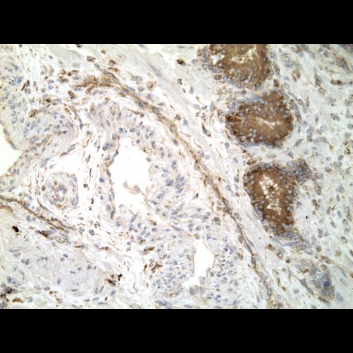  NCBI Organism:Homo sapiens; Cell Types:endocrine-paracrine cell of prostate gland, basal cell of prostate epithelium, luminal cell of prostate epithelium, blood vessel endothelial cell, perineural cell, sheath cell, leukocyte, prostate stromal cell, smooth muscle cell of prostate; Cell Components:nucleus, cell surface;