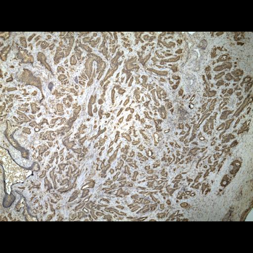  NCBI Organism:Homo sapiens; Cell Types:endocrine-paracrine cell of prostate gland, basal cell of prostate epithelium, luminal cell of prostate epithelium, blood vessel endothelial cell, perineural cell, sheath cell, leukocyte, prostate stromal cell, smooth muscle cell of prostate; Cell Components:nucleus, cell surface;