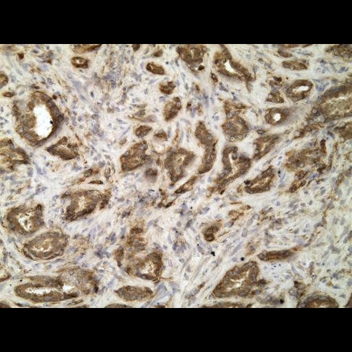  NCBI Organism:Homo sapiens; Cell Types:endocrine-paracrine cell of prostate gland, basal cell of prostate epithelium, luminal cell of prostate epithelium, blood vessel endothelial cell, perineural cell, sheath cell, leukocyte, prostate stromal cell, smooth muscle cell of prostate; Cell Components:nucleus, cell surface;