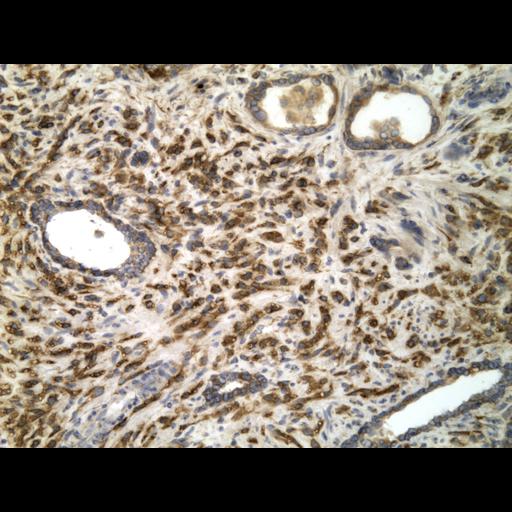  NCBI Organism:Homo sapiens; Cell Types:endocrine-paracrine cell of prostate gland, basal cell of prostate epithelium, luminal cell of prostate epithelium, blood vessel endothelial cell, perineural cell, sheath cell, leukocyte, prostate stromal cell, smooth muscle cell of prostate; Cell Components:nucleus, cell surface;