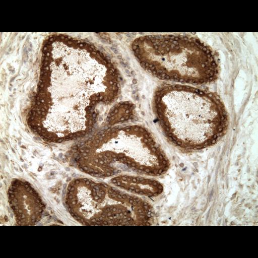  NCBI Organism:Homo sapiens; Cell Types:endocrine-paracrine cell of prostate gland, basal cell of prostate epithelium, luminal cell of prostate epithelium, blood vessel endothelial cell, perineural cell, sheath cell, leukocyte, prostate stromal cell, smooth muscle cell of prostate; Cell Components:nucleus, cell surface;