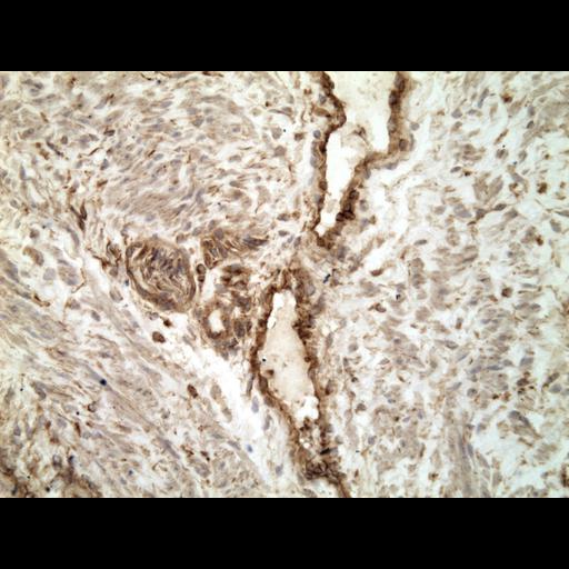  NCBI Organism:Homo sapiens; Cell Types:endocrine-paracrine cell of prostate gland, basal cell of prostate epithelium, luminal cell of prostate epithelium, blood vessel endothelial cell, perineural cell, sheath cell, leukocyte, prostate stromal cell, smooth muscle cell of prostate; Cell Components:nucleus, cell surface;