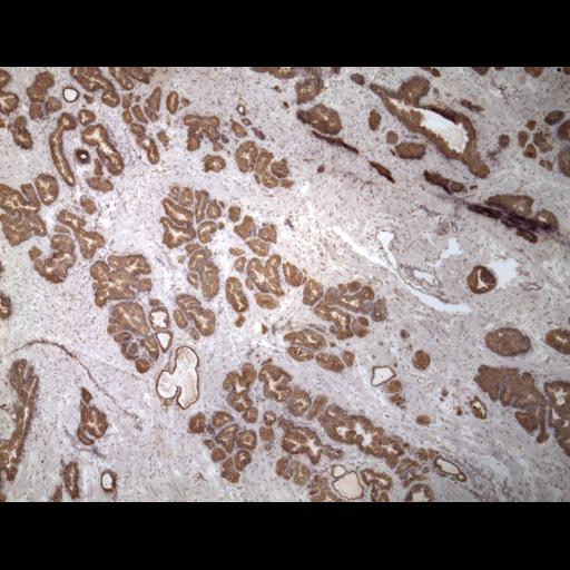  NCBI Organism:Homo sapiens; Cell Types:endocrine-paracrine cell of prostate gland, basal cell of prostate epithelium, luminal cell of prostate epithelium, blood vessel endothelial cell, perineural cell, sheath cell, leukocyte, prostate stromal cell, smooth muscle cell of prostate; Cell Components:nucleus, cell surface;