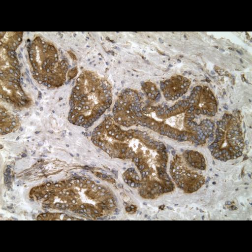  NCBI Organism:Homo sapiens; Cell Types:endocrine-paracrine cell of prostate gland, basal cell of prostate epithelium, luminal cell of prostate epithelium, blood vessel endothelial cell, perineural cell, sheath cell, leukocyte, prostate stromal cell, smooth muscle cell of prostate; Cell Components:nucleus, cell surface;