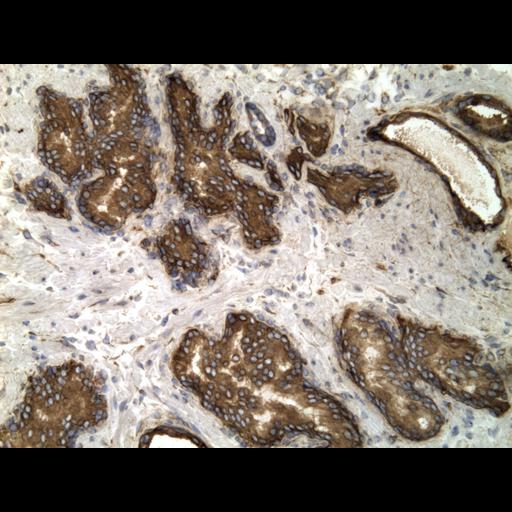  NCBI Organism:Homo sapiens; Cell Types:endocrine-paracrine cell of prostate gland, basal cell of prostate epithelium, luminal cell of prostate epithelium, blood vessel endothelial cell, perineural cell, sheath cell, leukocyte, prostate stromal cell, smooth muscle cell of prostate; Cell Components:nucleus, cell surface;