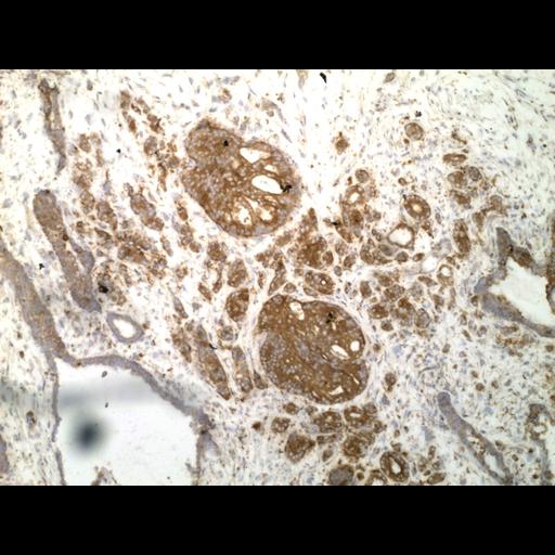  NCBI Organism:Homo sapiens; Cell Types:endocrine-paracrine cell of prostate gland, basal cell of prostate epithelium, luminal cell of prostate epithelium, blood vessel endothelial cell, perineural cell, sheath cell, leukocyte, prostate stromal cell, smooth muscle cell of prostate; Cell Components:nucleus, cell surface;