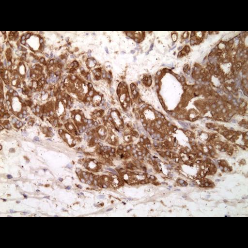  NCBI Organism:Homo sapiens; Cell Types:endocrine-paracrine cell of prostate gland, basal cell of prostate epithelium, luminal cell of prostate epithelium, blood vessel endothelial cell, perineural cell, sheath cell, leukocyte, prostate stromal cell, smooth muscle cell of prostate; Cell Components:nucleus, cell surface;