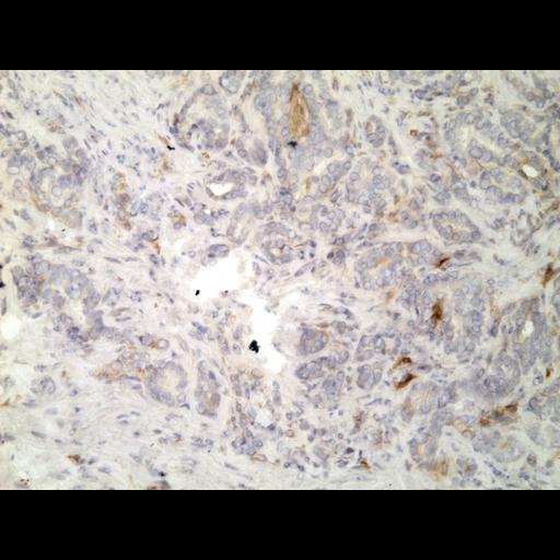  NCBI Organism:Homo sapiens; Cell Types:endocrine-paracrine cell of prostate gland, basal cell of prostate epithelium, luminal cell of prostate epithelium, blood vessel endothelial cell, perineural cell, sheath cell, leukocyte, prostate stromal cell, smooth muscle cell of prostate; Cell Components:nucleus, cell surface;