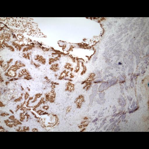  NCBI Organism:Homo sapiens; Cell Types:endocrine-paracrine cell of prostate gland, basal cell of prostate epithelium, luminal cell of prostate epithelium, blood vessel endothelial cell, perineural cell, sheath cell, leukocyte, prostate stromal cell, smooth muscle cell of prostate; Cell Components:nucleus, cell surface;