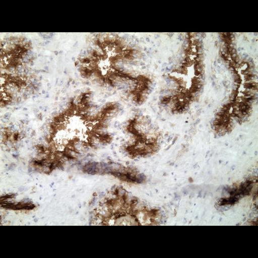  NCBI Organism:Homo sapiens; Cell Types:endocrine-paracrine cell of prostate gland, basal cell of prostate epithelium, luminal cell of prostate epithelium, blood vessel endothelial cell, perineural cell, sheath cell, leukocyte, prostate stromal cell, smooth muscle cell of prostate; Cell Components:nucleus, cell surface;