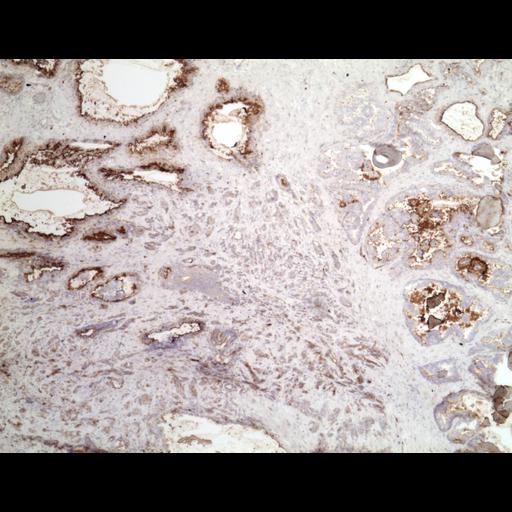  NCBI Organism:Homo sapiens; Cell Types:endocrine-paracrine cell of prostate gland, basal cell of prostate epithelium, luminal cell of prostate epithelium, blood vessel endothelial cell, perineural cell, sheath cell, leukocyte, prostate stromal cell, smooth muscle cell of prostate; Cell Components:nucleus, cell surface;