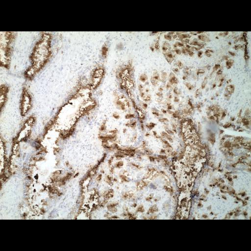  NCBI Organism:Homo sapiens; Cell Types:endocrine-paracrine cell of prostate gland, basal cell of prostate epithelium, luminal cell of prostate epithelium, blood vessel endothelial cell, perineural cell, sheath cell, leukocyte, prostate stromal cell, smooth muscle cell of prostate; Cell Components:nucleus, cell surface;