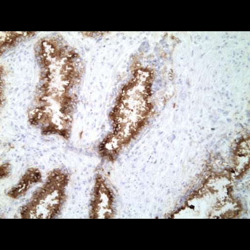  NCBI Organism:Homo sapiens; Cell Types:endocrine-paracrine cell of prostate gland, basal cell of prostate epithelium, luminal cell of prostate epithelium, blood vessel endothelial cell, perineural cell, sheath cell, leukocyte, prostate stromal cell, smooth muscle cell of prostate; Cell Components:nucleus, cell surface;