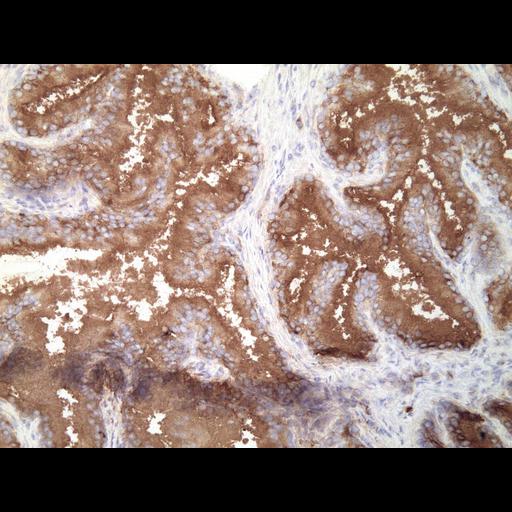  NCBI Organism:Homo sapiens; Cell Types:endocrine-paracrine cell of prostate gland, basal cell of prostate epithelium, luminal cell of prostate epithelium, blood vessel endothelial cell, perineural cell, sheath cell, leukocyte, prostate stromal cell, smooth muscle cell of prostate; Cell Components:nucleus, cell surface;