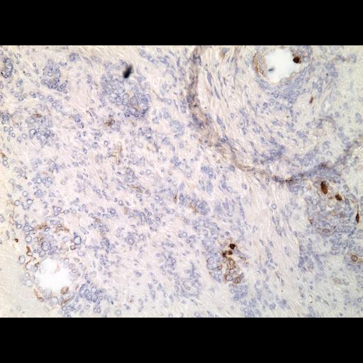  NCBI Organism:Homo sapiens; Cell Types:endocrine-paracrine cell of prostate gland, basal cell of prostate epithelium, luminal cell of prostate epithelium, blood vessel endothelial cell, perineural cell, sheath cell, leukocyte, prostate stromal cell, smooth muscle cell of prostate; Cell Components:nucleus, cell surface;