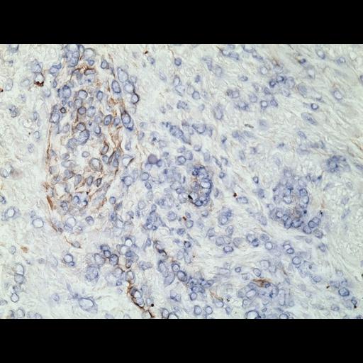  NCBI Organism:Homo sapiens; Cell Types:endocrine-paracrine cell of prostate gland, basal cell of prostate epithelium, luminal cell of prostate epithelium, blood vessel endothelial cell, perineural cell, sheath cell, leukocyte, prostate stromal cell, smooth muscle cell of prostate; Cell Components:nucleus, cell surface;