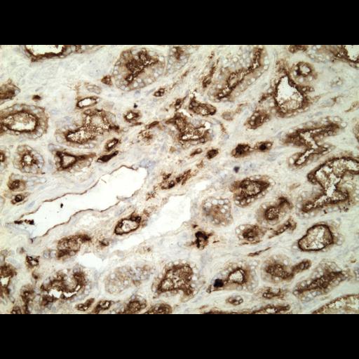  NCBI Organism:Homo sapiens; Cell Types:endocrine-paracrine cell of prostate gland, basal cell of prostate epithelium, luminal cell of prostate epithelium, blood vessel endothelial cell, perineural cell, sheath cell, leukocyte, prostate stromal cell, smooth muscle cell of prostate; Cell Components:nucleus, cell surface;