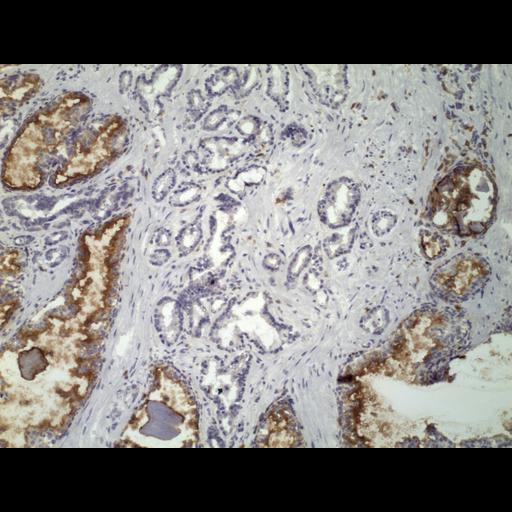  NCBI Organism:Homo sapiens; Cell Types:endocrine-paracrine cell of prostate gland, basal cell of prostate epithelium, luminal cell of prostate epithelium, blood vessel endothelial cell, perineural cell, sheath cell, leukocyte, prostate stromal cell, smooth muscle cell of prostate; Cell Components:nucleus, cell surface;