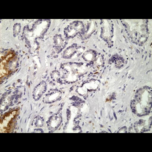  NCBI Organism:Homo sapiens; Cell Types:endocrine-paracrine cell of prostate gland, basal cell of prostate epithelium, luminal cell of prostate epithelium, blood vessel endothelial cell, perineural cell, sheath cell, leukocyte, prostate stromal cell, smooth muscle cell of prostate; Cell Components:nucleus, cell surface;