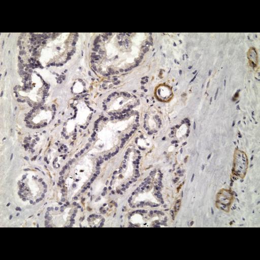  NCBI Organism:Homo sapiens; Cell Types:endocrine-paracrine cell of prostate gland, basal cell of prostate epithelium, luminal cell of prostate epithelium, blood vessel endothelial cell, perineural cell, sheath cell, leukocyte, prostate stromal cell, smooth muscle cell of prostate; Cell Components:nucleus, cell surface;